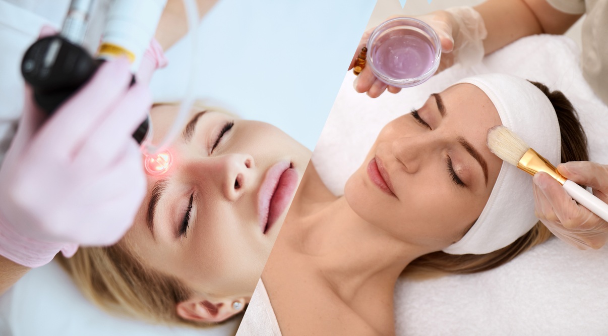 Side-by-side comparison showcasing a chemical peel application and a laser treatment session, highlighting the differences and benefits of each skin care method.