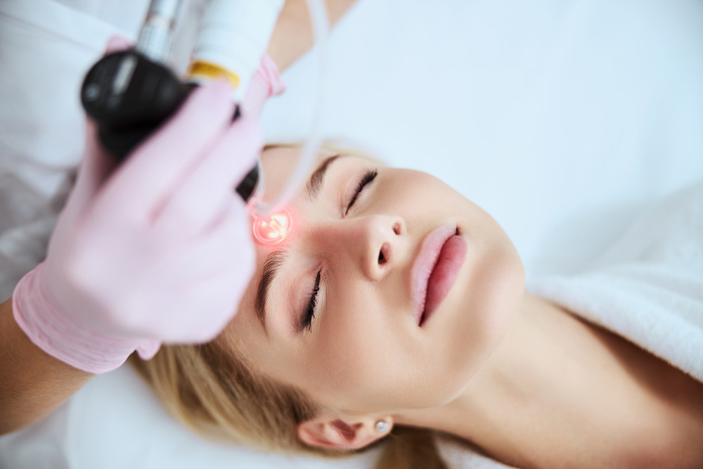 A woman receiving a precise laser treatment on her forehead, targeting skin imperfections for a radiant appearance.