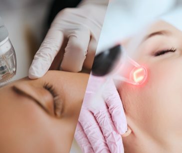 Comparison of microneedling and laser treatments for skin rejuvenation, showcasing their distinct approaches to enhancing skin texture and tone.